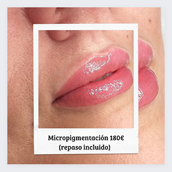 Galería de imágenes