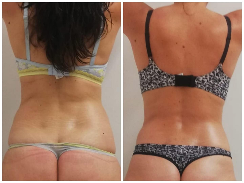 Centro De Est&eacute;tica Avanzada En San Juan Alicante- Kemana 5