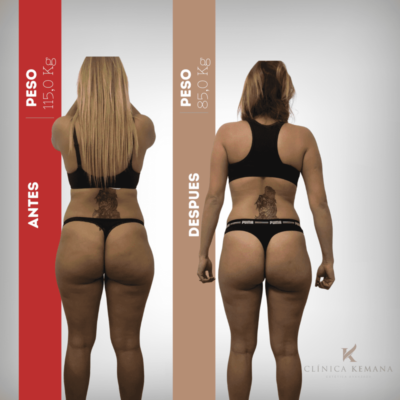 Centro De Est&eacute;tica Avanzada En San Juan Alicante- Kemana ESTETICA: CENTROS