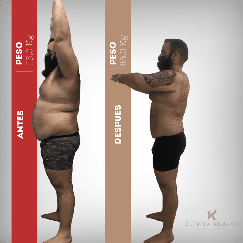 Centro De Est&eacute;tica Avanzada En San Juan Alicante- Kemana 2