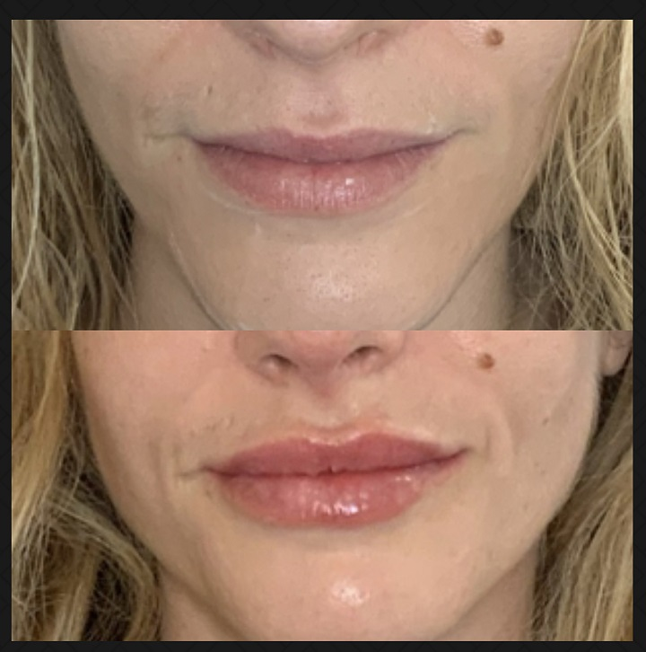 CB Clinic CLINICAS DE ESTETICA