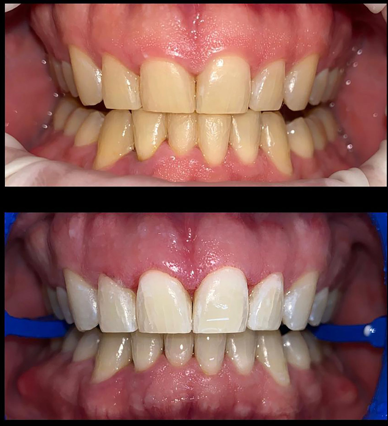 MC Lips - Matuca Lips 13