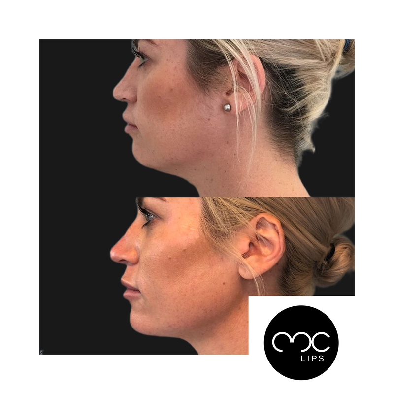 MC Lips - Matuca Lips 7