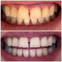 Galería de imágenes