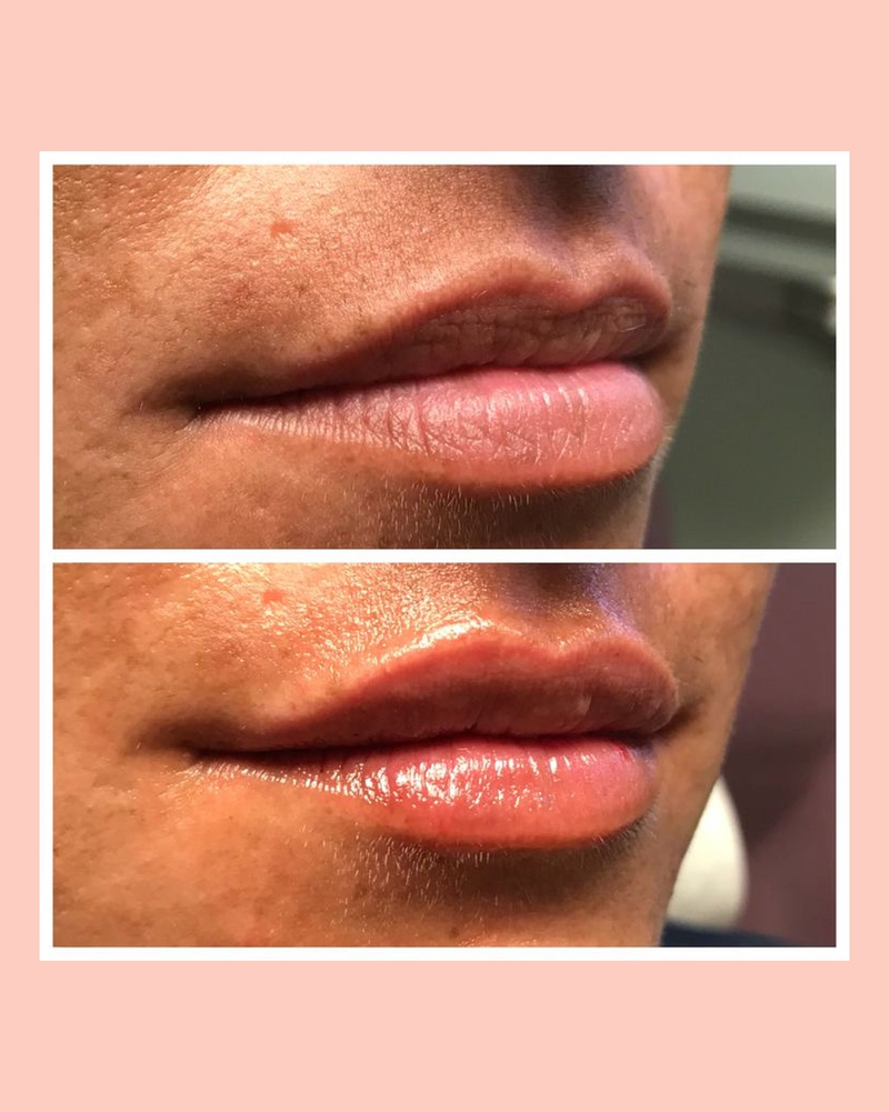 MC Lips - Matuca Lips 11