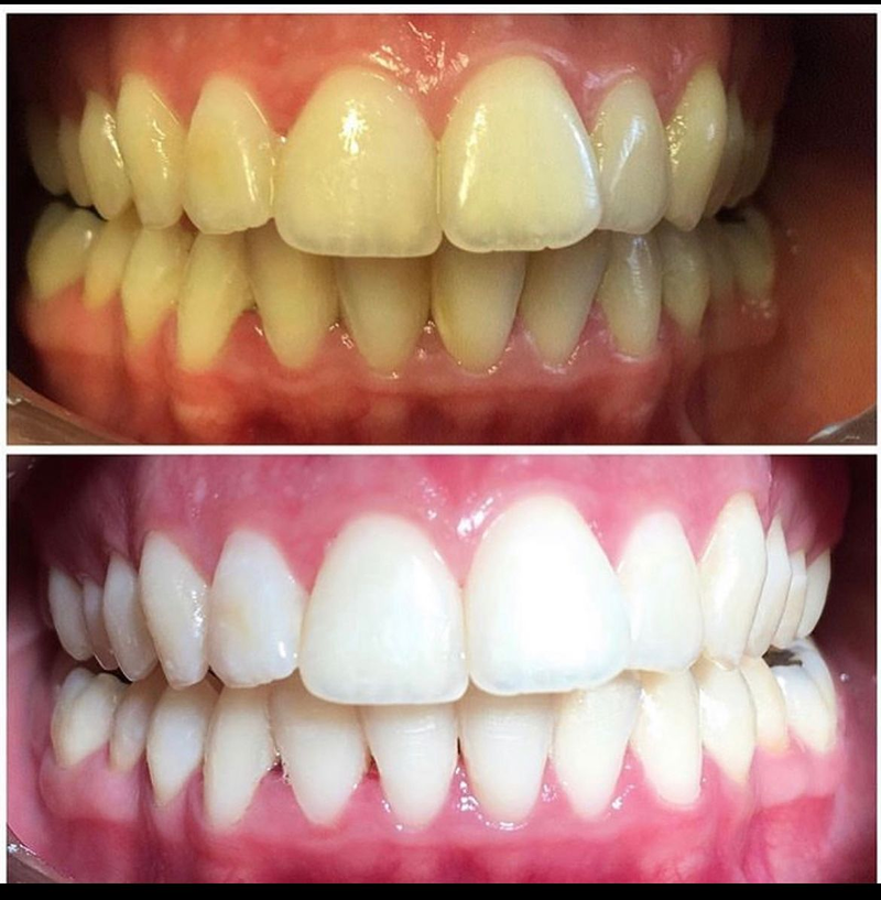 MC Lips - Matuca Lips 2