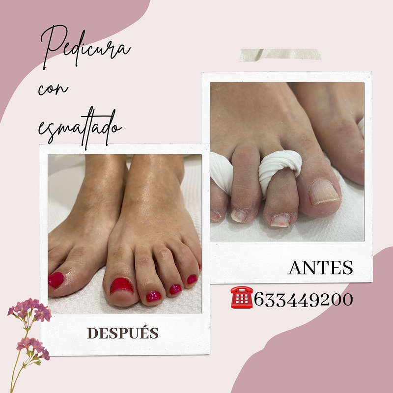 Centro Est&eacute;tica Lidia P&eacute;rez ESTETICA: CENTROS