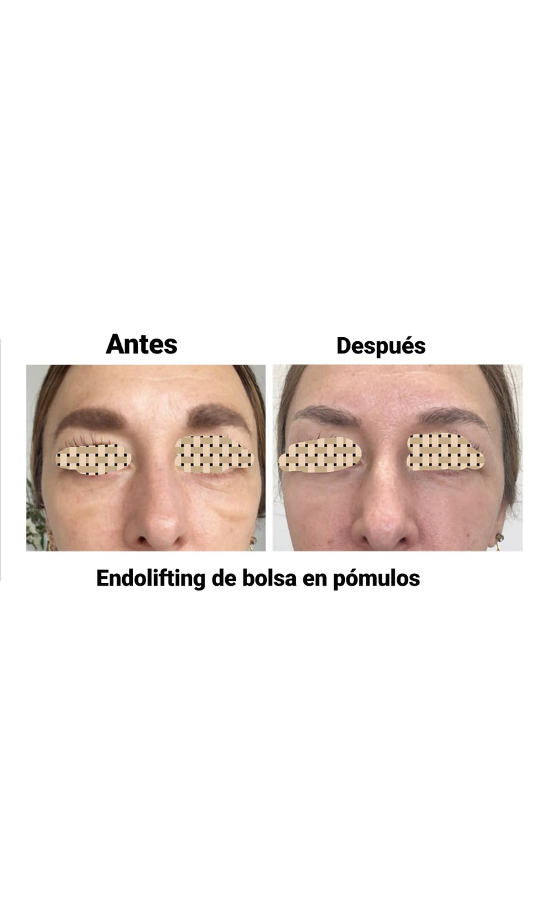 Est&eacute;tica M&eacute;dica 11