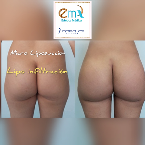 Est&eacute;tica M&eacute;dica 3