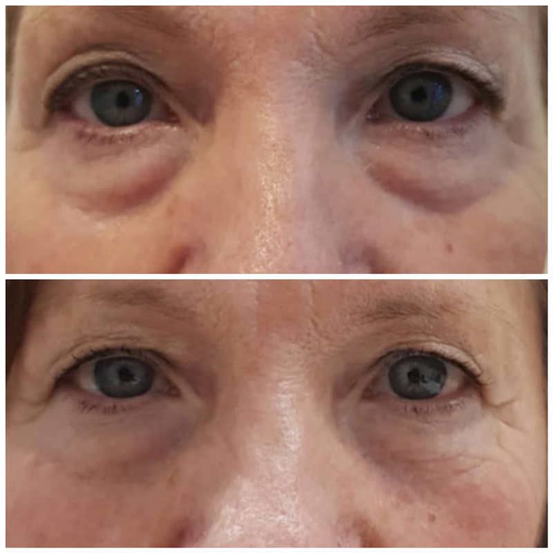 Est&eacute;tica M&eacute;dica 4