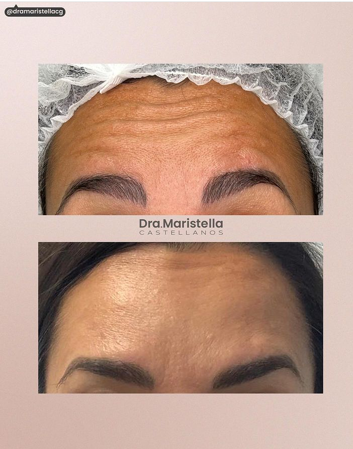 Medicina Est&eacute;tica Dra. Maristella Castellanos CLINICAS MEDICAS