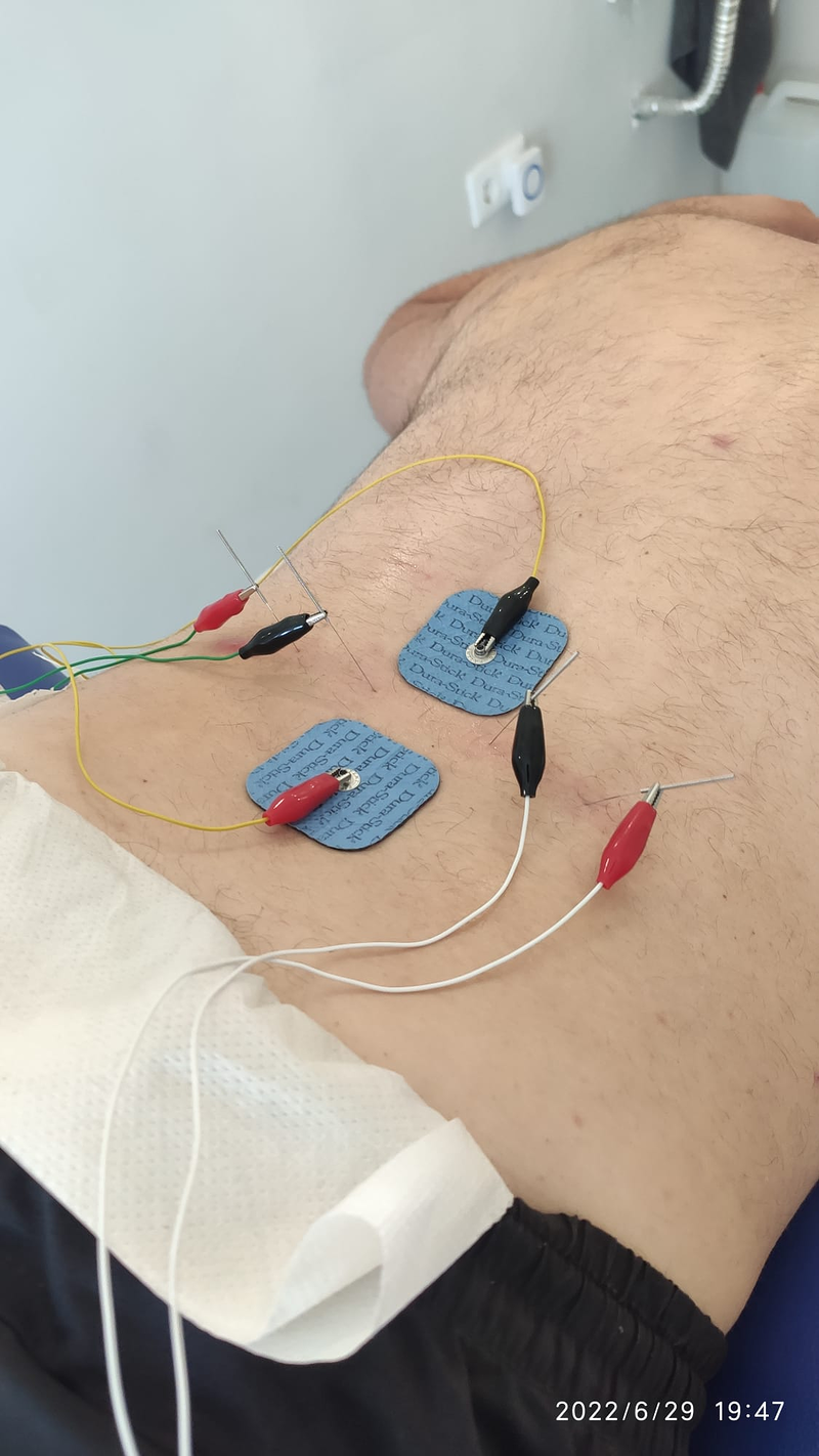 Fisioterapia Daniel Ruiz Alcantarilla