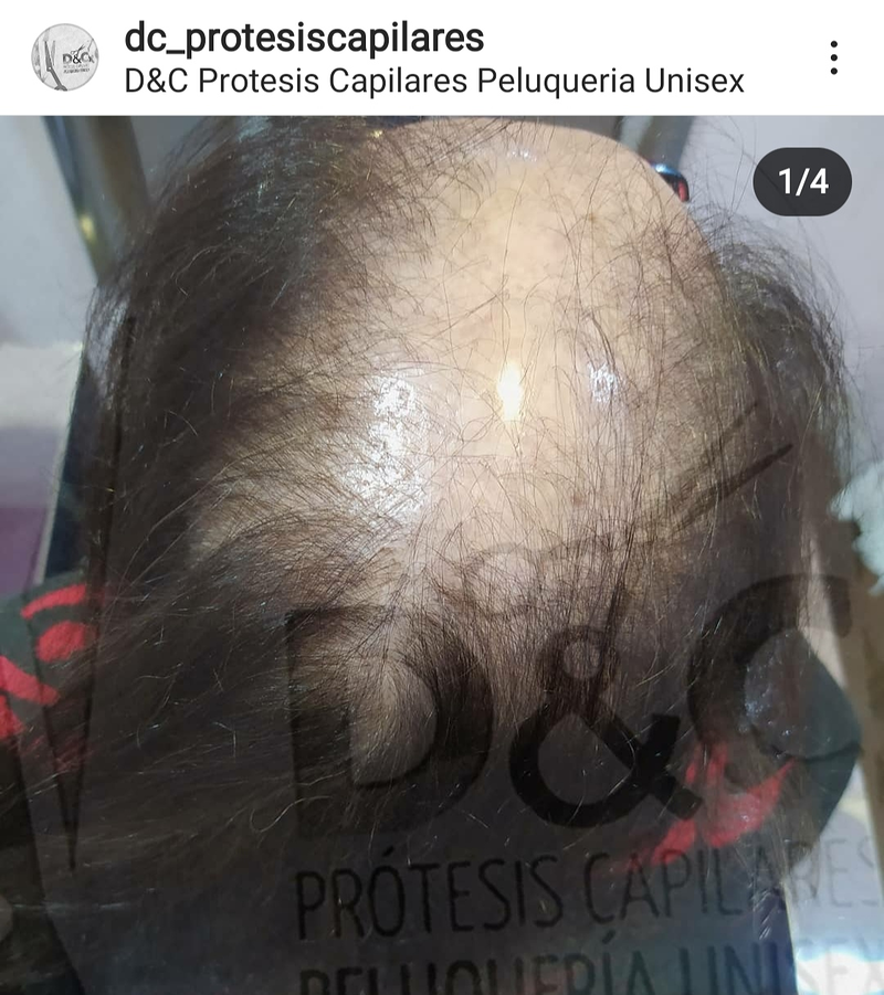 D&C Peluqueria Unisex Y Protesis Capilares 8