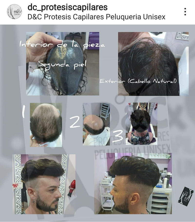 D&C Peluqueria Unisex Y Protesis Capilares 16