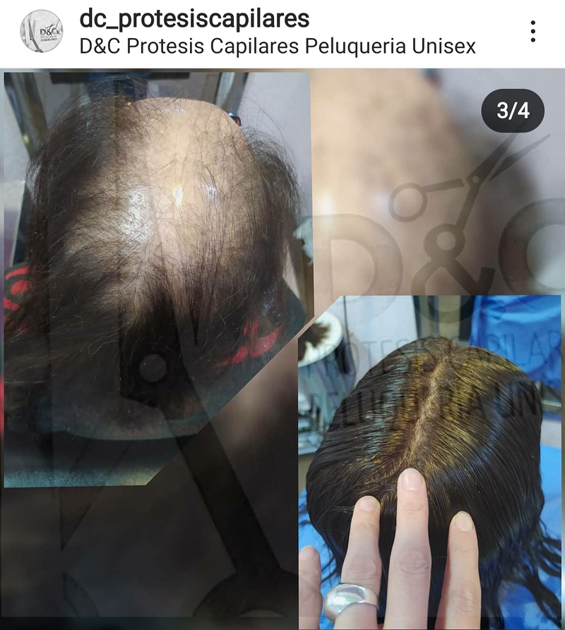 D&C Peluqueria Unisex Y Protesis Capilares 10