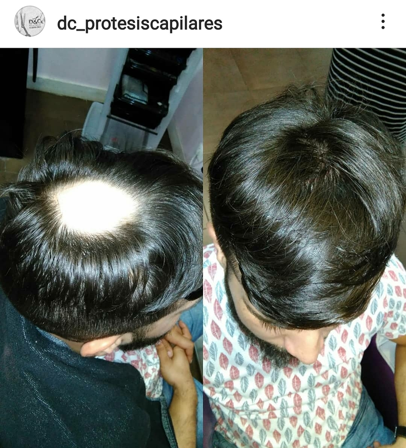 D&C Peluqueria Unisex Y Protesis Capilares 18