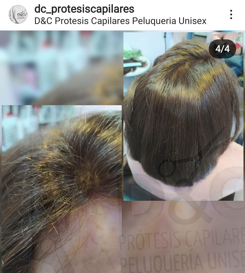 D&C Peluqueria Unisex Y Protesis Capilares 11