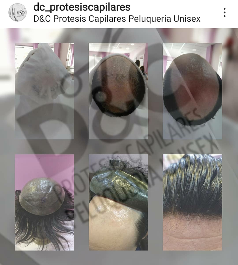D&C Peluqueria Unisex Y Protesis Capilares 13
