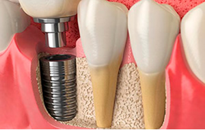 Nh Dental 5