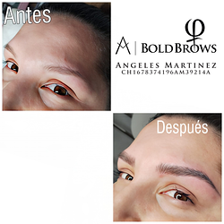 Galería de imágenes