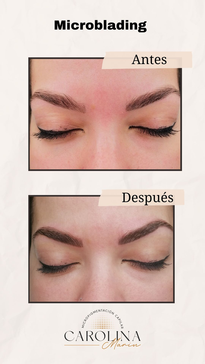 Carolina Marin Micropigmentacion Capilar MICROPIGMENTACION (MAQUILLAJE PERMANENTE): SERVICIOS