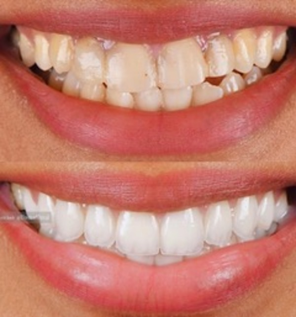 Alberto Villacieros | Villacieros Dental 10