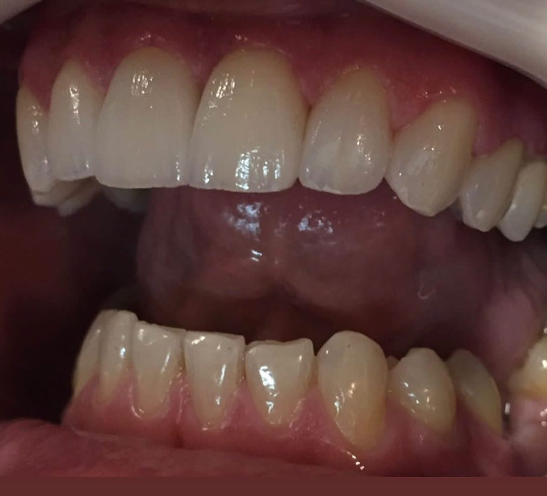 Cejas Lab 10