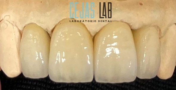 Cejas Lab 7