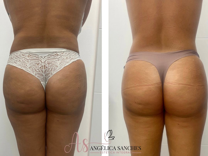 Angelica Sanches - Est&eacute;tica 7