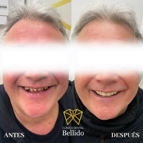 Cl&iacute;nica Dental Bellido 3