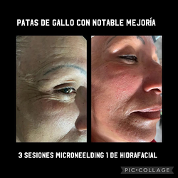 Galería de imágenes