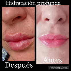 Galería de imágenes