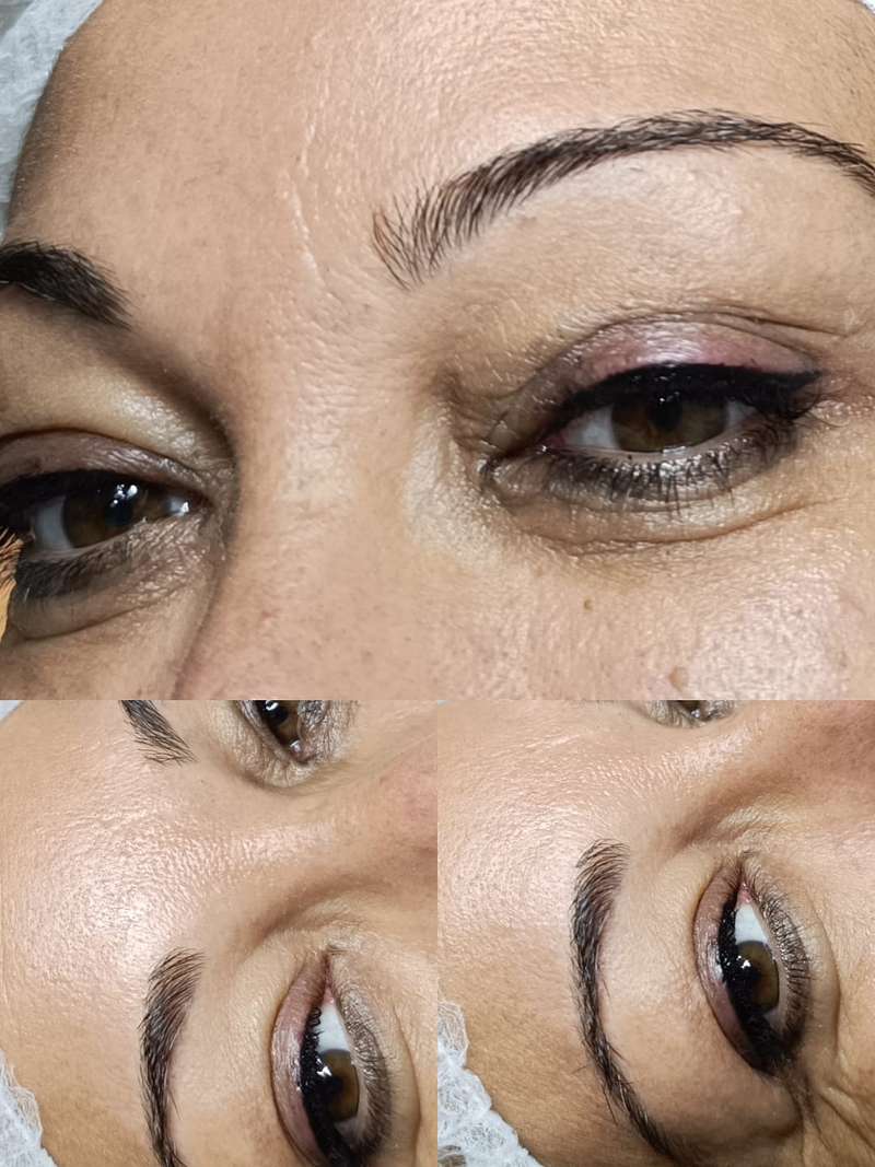 Liliana Est&eacute;tica 12