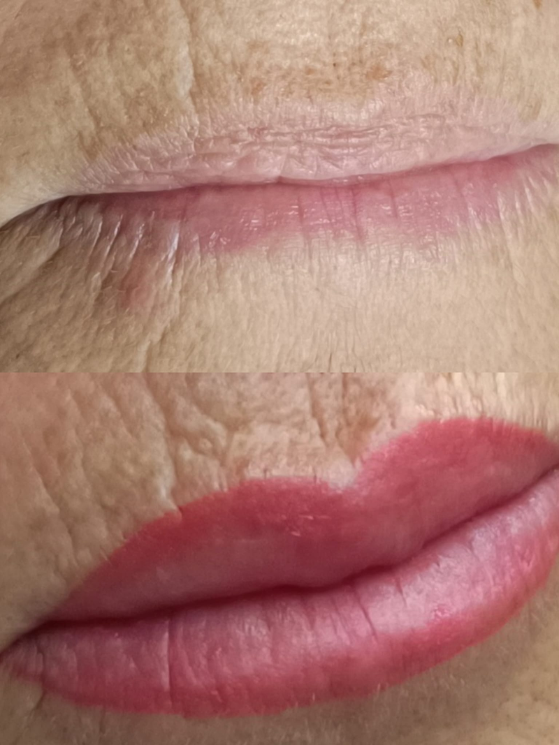 Liliana Est&eacute;tica 15