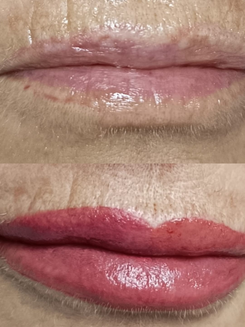 Liliana Est&eacute;tica 13