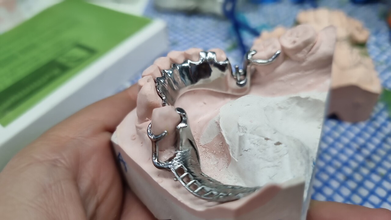 Abusu Dental LABORATORIOS DENTALES