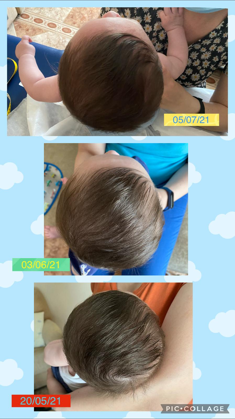 Neurekids & Babies - Fisioterapia y Osteopatia Pediatrica FISIOTERAPEUTAS