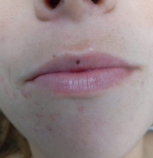 Centro Estético Tu Nuevo Yo Centro De Belleza Y Salud 15