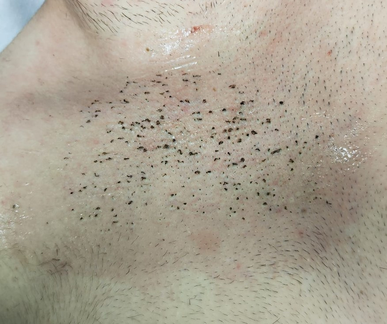 Centro Estético Tu Nuevo Yo Centro De Belleza Y Salud 22