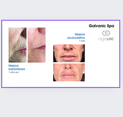 Galería de imágenes