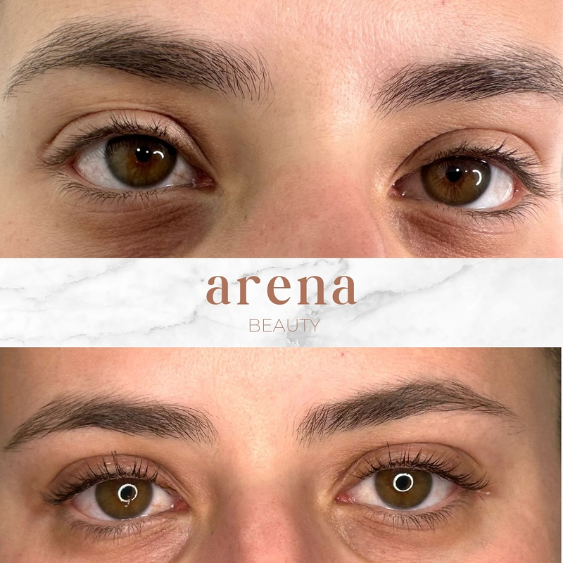 Arena Beauty 2