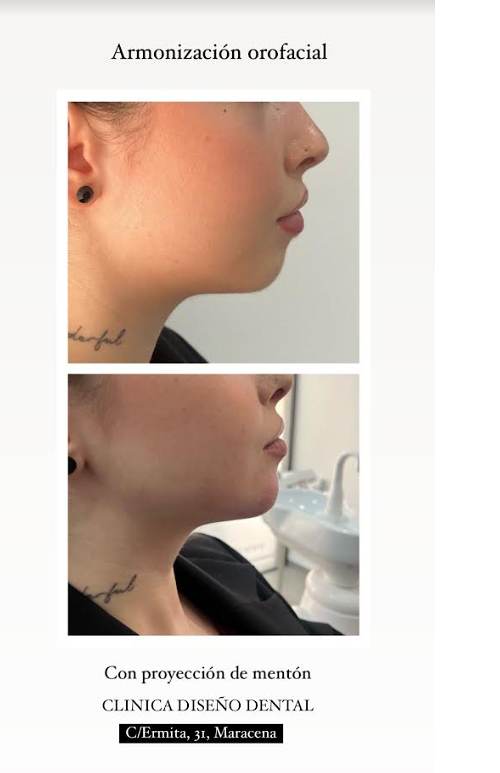 Clínica Diseño Dental Maracena