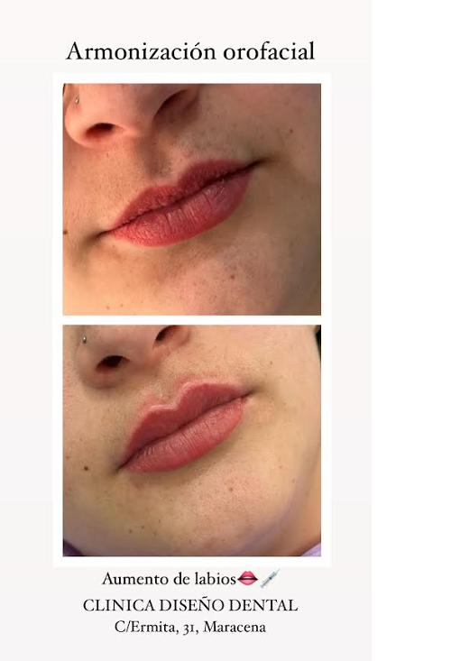 Clínica Diseño Dental 2