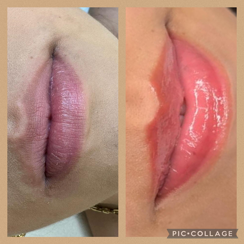 Harmony Esthetic & Spa Madrid