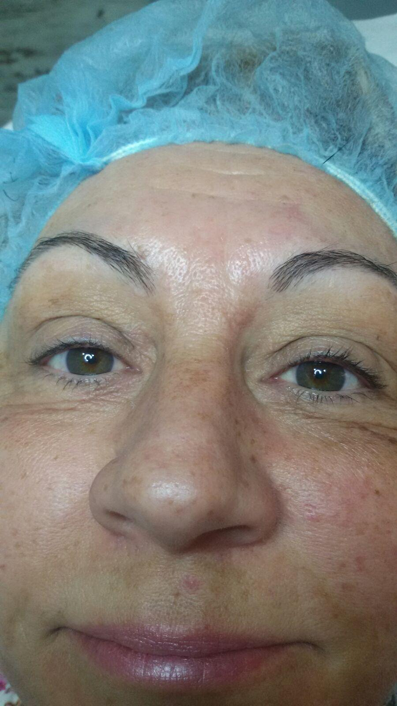 Fv Láser Nails Beauty 50