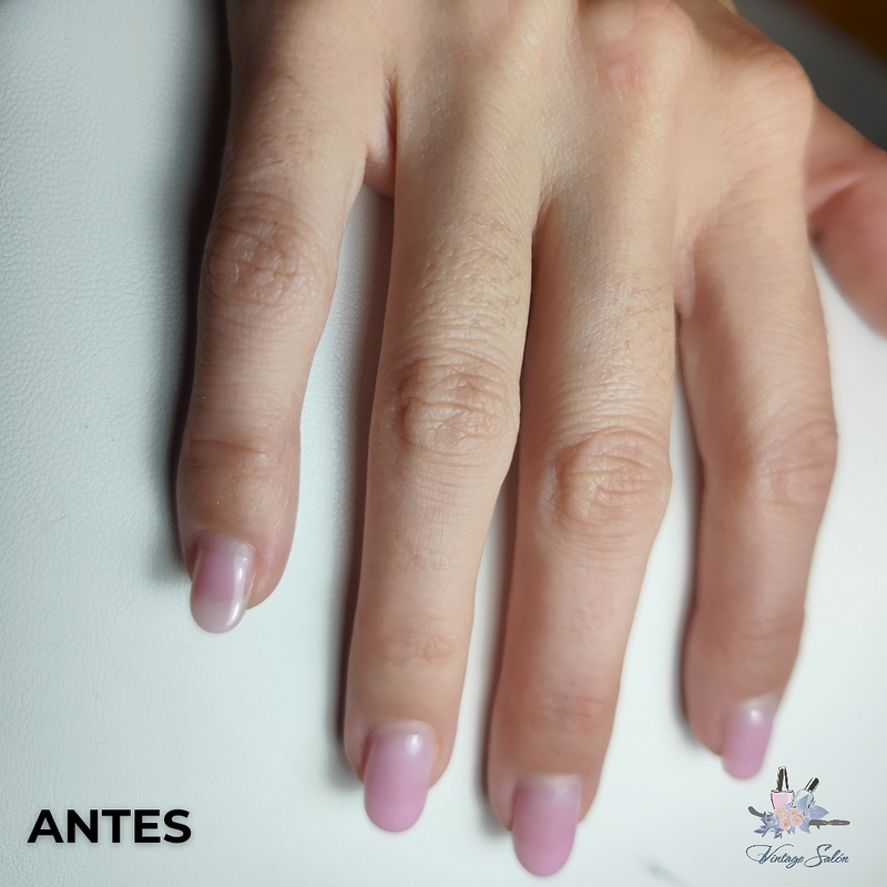 Fv Láser Nails Beauty 38