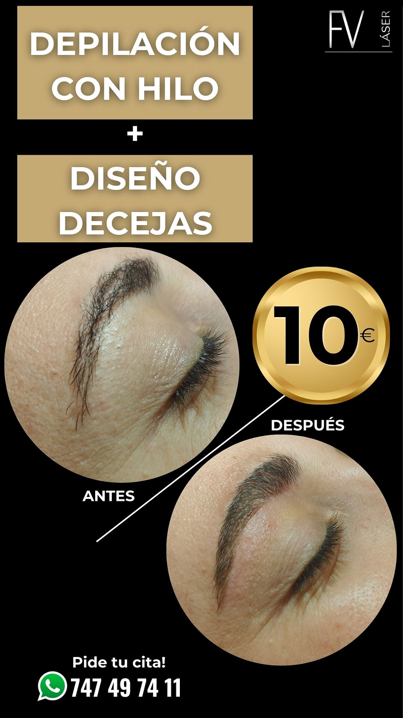 Fv Láser Nails Beauty 28