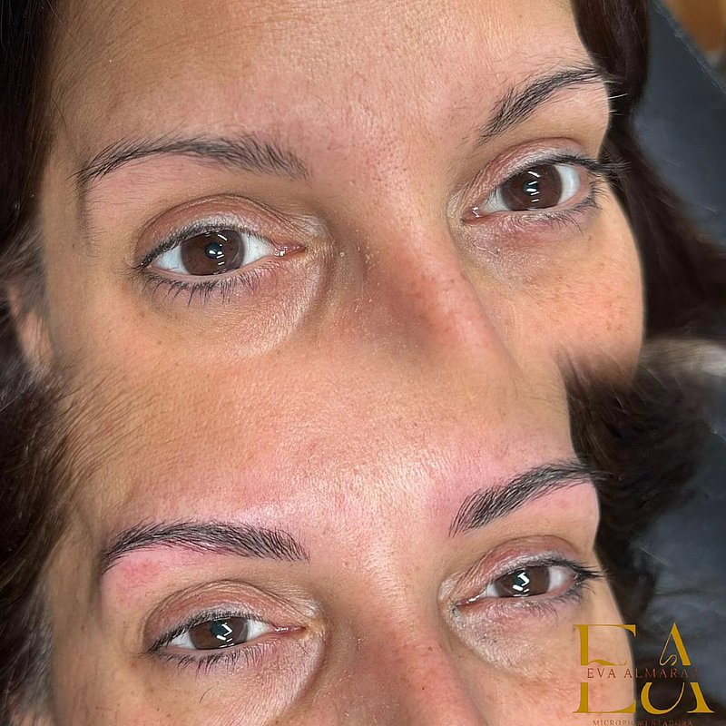 Fv Láser Nails Beauty 5