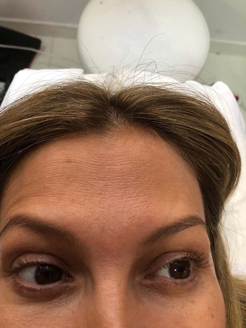 Fv Láser Nails Beauty 53