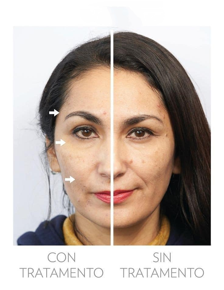 Fv Láser Nails Beauty 47